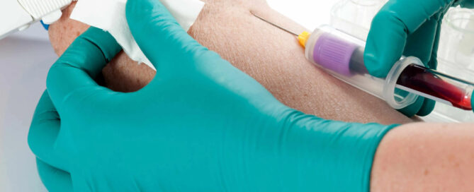 blood extraction