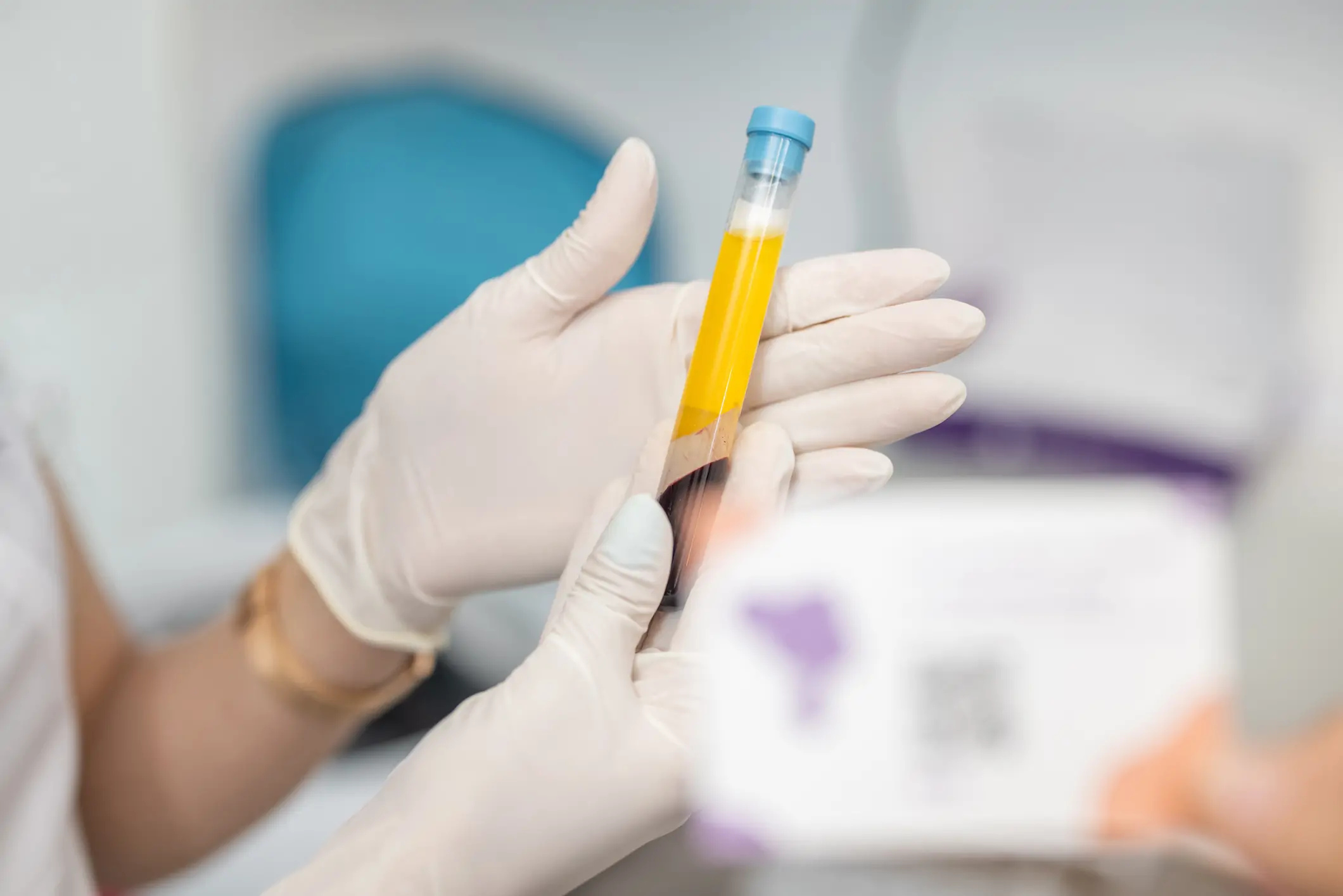 What Is Platelet-Rich Plasma (PRP) Therapy?